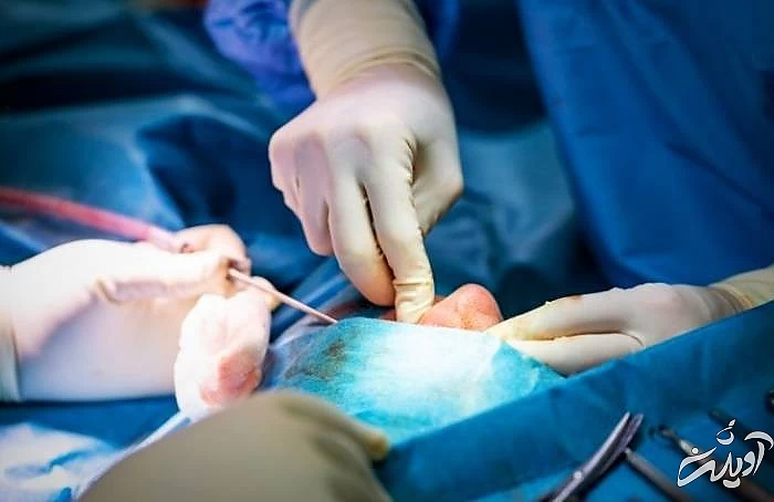 جراحی زیبایی بینی